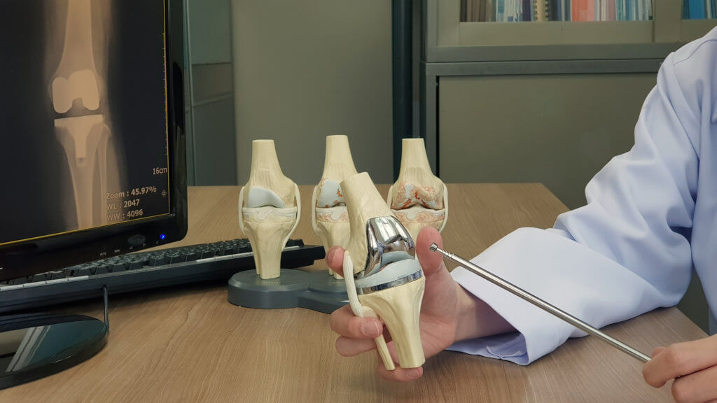An orthopedic surgeon shows a model of a replacement knee joint.