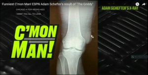 Adam Schefter’s knee X-ray is shown with ESPN’s Monday Night Football “C’Mon Man!” segment logo