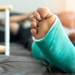 A patient with a green cast on their foot lays in bed with crutches next to them.