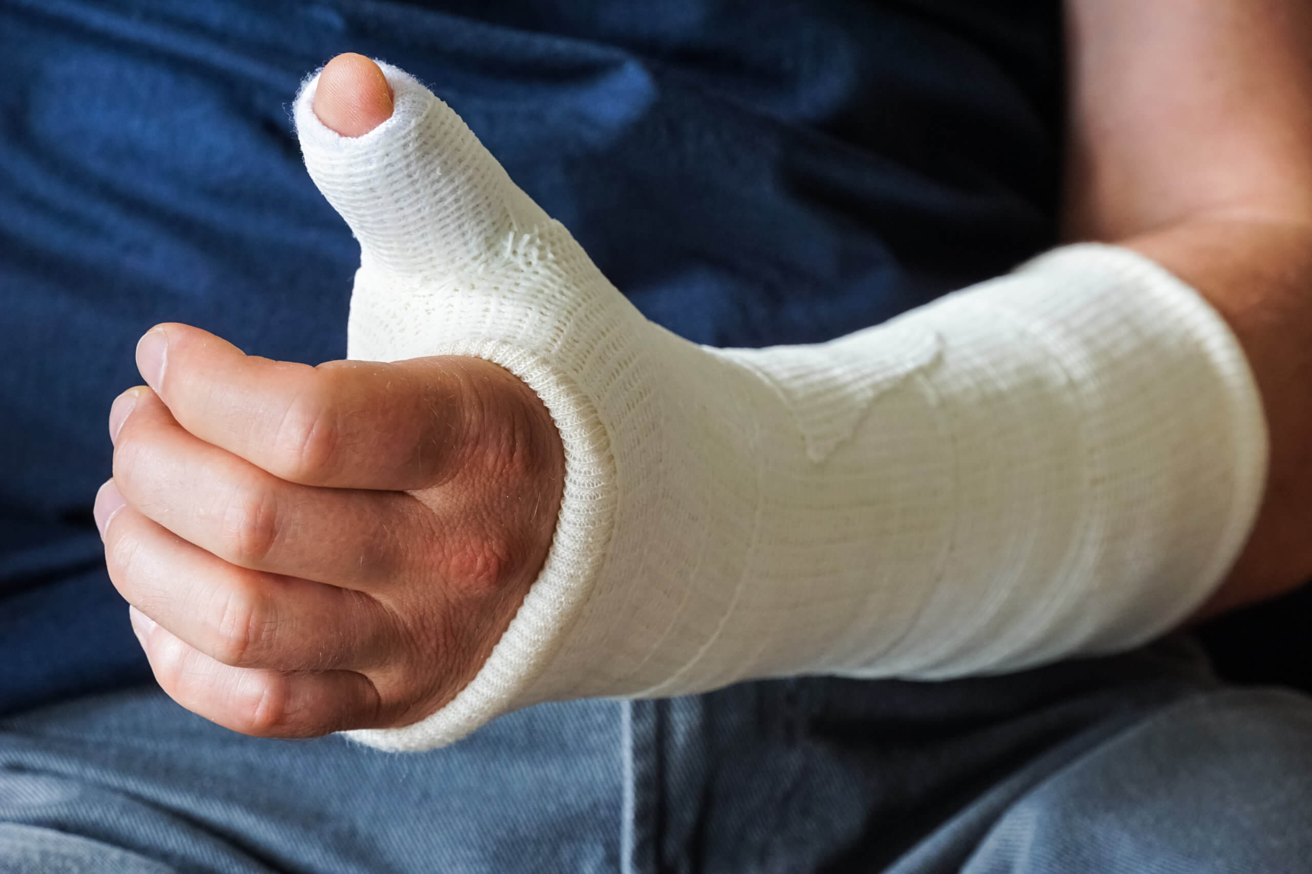 Man with a cast on wrist and thumb gives the “thumbs up.”