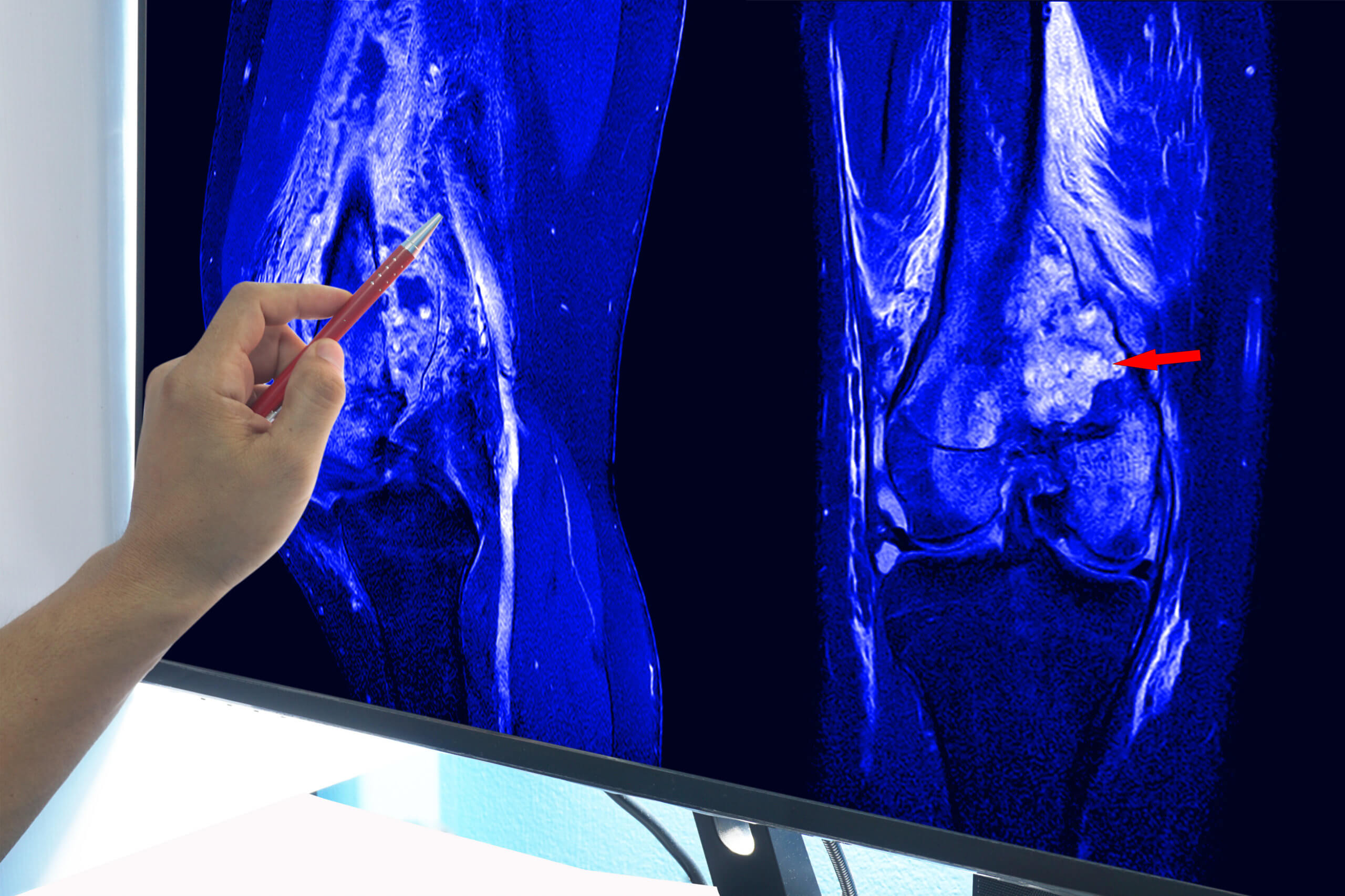 A technician reviews MRI scans of a patient’s knee