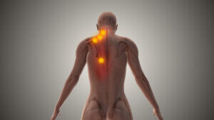 image of trigger point injection for back pain 