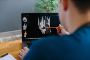 Orthopedic surgeon reviewing knee MRI for ACL surgery evaluation Long Island