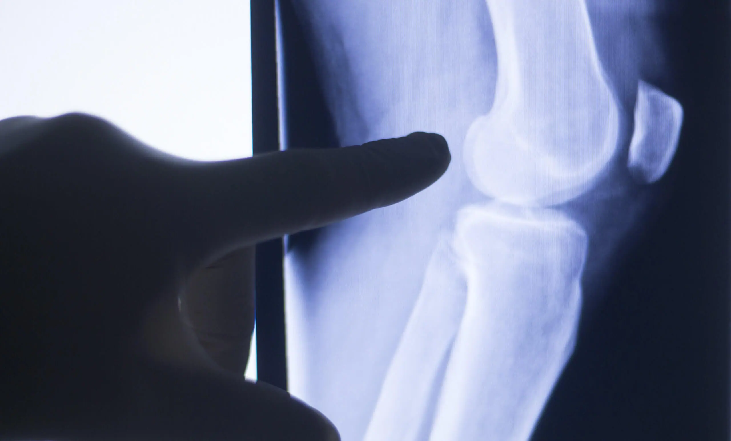 A doctor reviewing an X-ray image of a patient’s knee